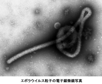 エボラウイルスの顕微鏡写真.jpg